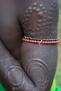 Example of scarification on an Ethopian man's arm